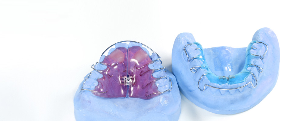 KFO - Dentallabor Kappert